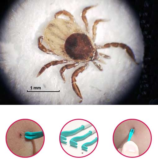 O'TOM Tick Twister 3-pack fästingplockare Blandade färger